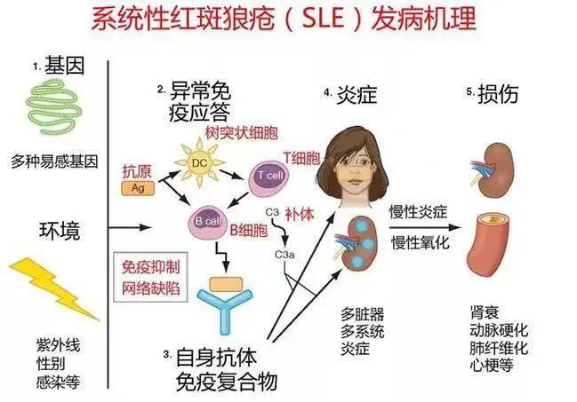 红斑狼疮的彩虹桥，复发之痛与希望之路