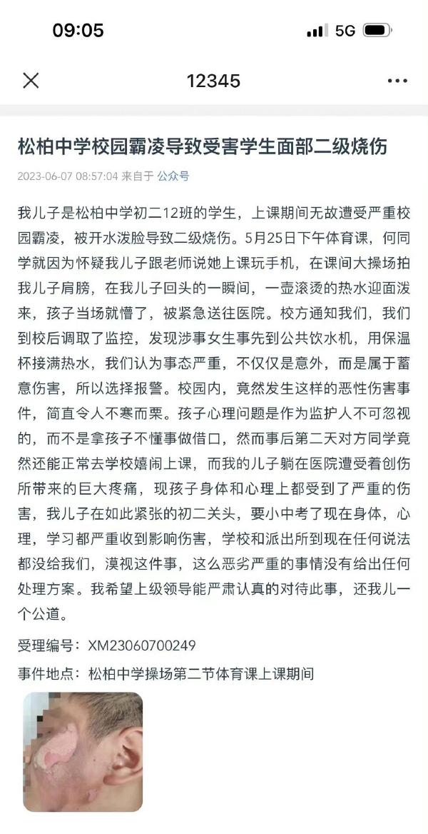 派出所回应6岁女童遭同学泼开水烫伤事件，案件进展及后续措施关注中