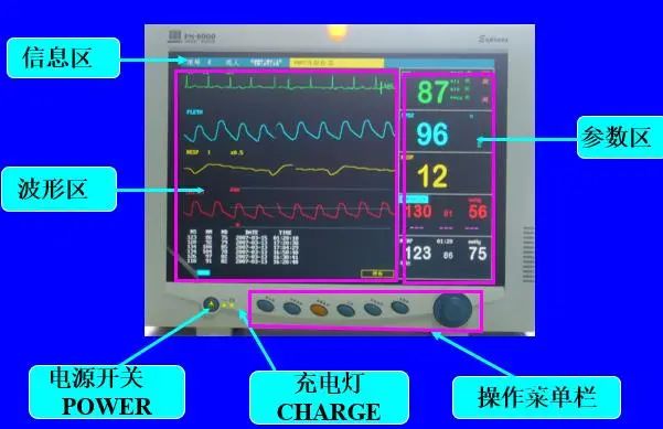 心电监护流程最新口述及日常新奇体验分享